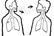 Tüberküloz Bulaşıcı mı? Tüberküloz Bulaşıcı mı?